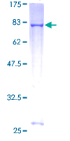 TRIM39 / RNF23 Protein - 12.5% SDS-PAGE of human TRIM39 stained with Coomassie Blue