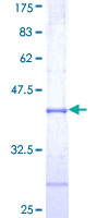 TRIM39 / RNF23 Protein - 12.5% SDS-PAGE Stained with Coomassie Blue.