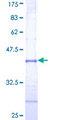 TRIM39 / RNF23 Protein - 12.5% SDS-PAGE Stained with Coomassie Blue.