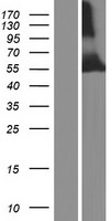 TRIM39-RPP21 Protein - Western validation with an anti-DDK antibody * L: Control HEK293 lysate R: Over-expression lysate