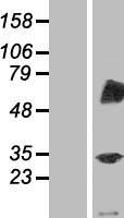 TRIM4 / RNF87 Protein - Western validation with an anti-DDK antibody * L: Control HEK293 lysate R: Over-expression lysate