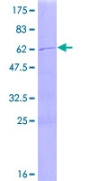 TRIM4 / RNF87 Protein - 12.5% SDS-PAGE of human TRIM4 stained with Coomassie Blue