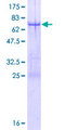 TRIM44 Protein - 12.5% SDS-PAGE of human TRIM44 stained with Coomassie Blue