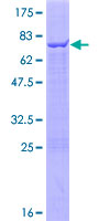 TRIM47 Protein - 12.5% SDS-PAGE of human TRIM47 stained with Coomassie Blue