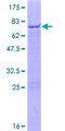 TRIM47 Protein - 12.5% SDS-PAGE of human TRIM47 stained with Coomassie Blue