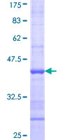 TRIM47 Protein - 12.5% SDS-PAGE Stained with Coomassie Blue.
