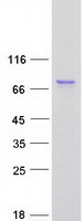TRIM47 Protein - Purified recombinant protein TRIM47 was analyzed by SDS-PAGE gel and Coomassie Blue Staining