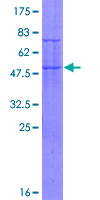 TRIM48 / RNF101 Protein - 12.5% SDS-PAGE of human TRIM48 stained with Coomassie Blue