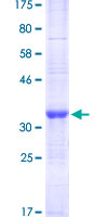 TRIM49 Protein - 12.5% SDS-PAGE Stained with Coomassie Blue.
