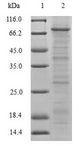 TRIM5 Protein - (Tris-Glycine gel) Discontinuous SDS-PAGE (reduced) with 5% enrichment gel and 15% separation gel.