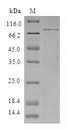 TRIM5 Protein - (Tris-Glycine gel) Discontinuous SDS-PAGE (reduced) with 5% enrichment gel and 15% separation gel.
