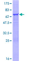 TRIM5 Protein - 12.5% SDS-PAGE of human TRIM5 stained with Coomassie Blue