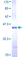 TRIM5 Protein - 12.5% SDS-PAGE Stained with Coomassie Blue.