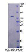 TRIM5 Protein - Recombinant Tripartite Motif Containing Protein 5 (TRIM5) by SDS-PAGE