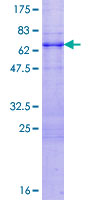 TRIM52 Protein - 12.5% SDS-PAGE of human TRIM52 stained with Coomassie Blue