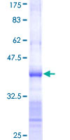 TRIM52 Protein - 12.5% SDS-PAGE Stained with Coomassie Blue.