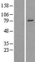 TRIM56 Protein - Western validation with an anti-DDK antibody * L: Control HEK293 lysate R: Over-expression lysate