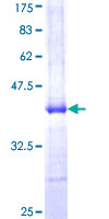 TRIM56 Protein - 12.5% SDS-PAGE Stained with Coomassie Blue