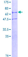 TRIM59 Protein - 12.5% SDS-PAGE of human TRIM59 stained with Coomassie Blue