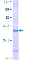 TRIM6 Protein - 12.5% SDS-PAGE Stained with Coomassie Blue.