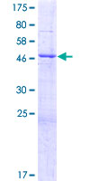 TRIM61 Protein - 12.5% SDS-PAGE of human TRIM61 stained with Coomassie Blue