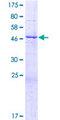 TRIM61 Protein - 12.5% SDS-PAGE of human TRIM61 stained with Coomassie Blue