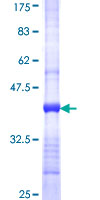 TRIM61 Protein - 12.5% SDS-PAGE Stained with Coomassie Blue.
