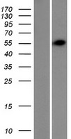 TRIM62 Protein - Western validation with an anti-DDK antibody * L: Control HEK293 lysate R: Over-expression lysate