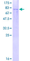 TRIM62 Protein - 12.5% SDS-PAGE of human TRIM62 stained with Coomassie Blue