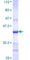 TRIM62 Protein - 12.5% SDS-PAGE Stained with Coomassie Blue.