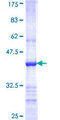 TRIM62 Protein - 12.5% SDS-PAGE Stained with Coomassie Blue.