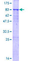 TRIM65 Protein - 12.5% SDS-PAGE of human TRIM65 stained with Coomassie Blue