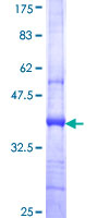 TRIM65 Protein - 12.5% SDS-PAGE Stained with Coomassie Blue.