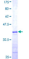 TRIM68 Protein - 12.5% SDS-PAGE Stained with Coomassie Blue.