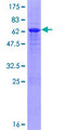 TRIM69 / Trif Protein - 12.5% SDS-PAGE of human RNF36 stained with Coomassie Blue