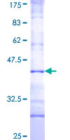 TRIM69 / Trif Protein - 12.5% SDS-PAGE Stained with Coomassie Blue.