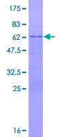 TRIM72 / MG53 Protein - 12.5% SDS-PAGE of human LOC493829 stained with Coomassie Blue