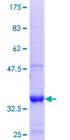 TRIM72 / MG53 Protein - 12.5% SDS-PAGE Stained with Coomassie Blue.