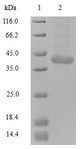 TRIM72 / MG53 Protein - (Tris-Glycine gel) Discontinuous SDS-PAGE (reduced) with 5% enrichment gel and 15% separation gel.