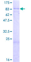 TRIM8 / GERP Protein - 12.5% SDS-PAGE of human TRIM8 stained with Coomassie Blue