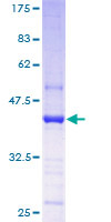 Trimethylguanosine Synthase 1 Protein - 12.5% SDS-PAGE of human NCOA6IP stained with Coomassie Blue