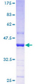 Trimethylguanosine Synthase 1 Protein - 12.5% SDS-PAGE of human NCOA6IP stained with Coomassie Blue