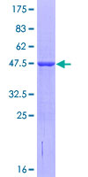 TRIML1 Protein - 12.5% SDS-PAGE of human FLJ36180 stained with Coomassie Blue