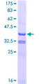 TRIO Protein - 12.5% SDS-PAGE Stained with Coomassie Blue.