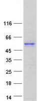 TRIOBP Protein - Purified recombinant protein TRIOBP was analyzed by SDS-PAGE gel and Coomassie Blue Staining