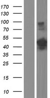 TRIP / LRRFIP1 Protein - Western validation with an anti-DDK antibody * L: Control HEK293 lysate R: Over-expression lysate