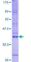 TRIP / LRRFIP1 Protein - 12.5% SDS-PAGE of human LRRFIP1 stained with Coomassie Blue