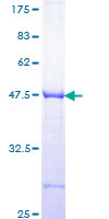 TRIP / LRRFIP1 Protein - 12.5% SDS-PAGE Stained with Coomassie Blue.