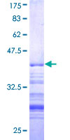 TRIP12 Protein - 12.5% SDS-PAGE Stained with Coomassie Blue.