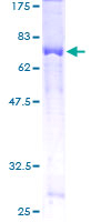TRIP13 Protein - 12.5% SDS-PAGE of human TRIP13 stained with Coomassie Blue